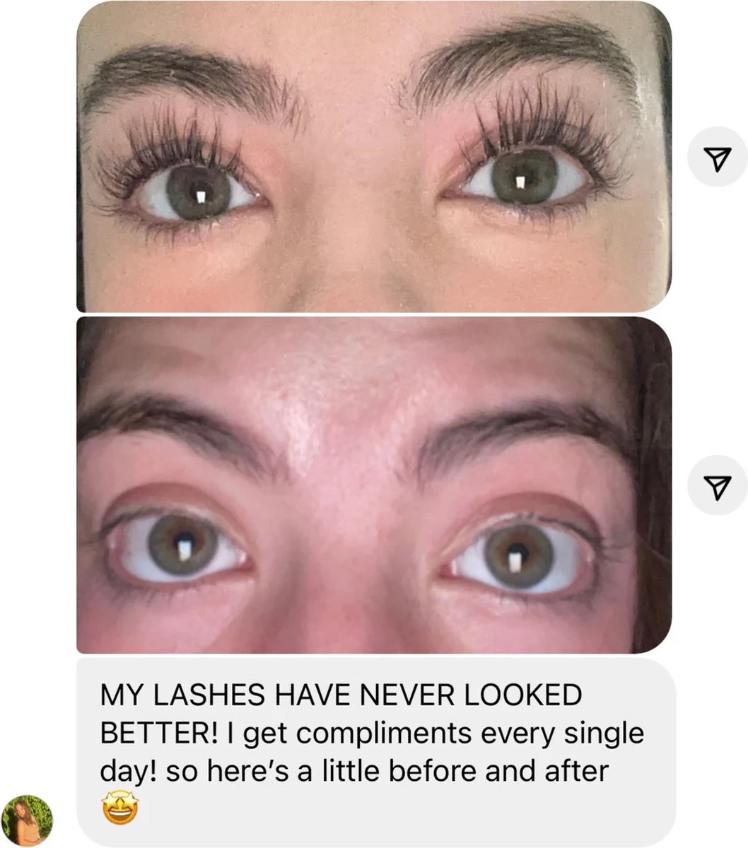 NATURA LASHES - WIMPERSERUM - LASH SERUM - EYELASH GROWTH SERUM - ECHTE RESULTATEN - TOT 55% LANGER EN 75% VOLUMINEUZER OGENDE WIMPERS 5 NATURA LASHES - WIMPERSERUM - LASH SERUM - EYELASH GROWTH SERUM - ECHTE RESULTATEN - TOT 55% LANGER EN 75% VOLUMINEUZER OGENDE WIMPERS - Afbeelding 3