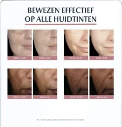 Eucerin Anti-Pigment Spotcorrector - Concealer - 5 Ml 16 Eucerin Anti-Pigment Spotcorrector - Concealer - 5 Ml -Cosmeticawinkel 1157x1200 1