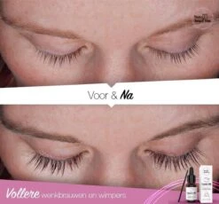 Your Beauty Tree ® Wimper Serum Met Echte Castor Olie |100% Natuurlijke Wimpergroei| Castor Oil Eyelash Serum|Wonder Olie | Wimper Groei | Wenkbrauw Serum | Lash Serum | Wimper Groeimiddel -Cosmeticawinkel 1200x1115 2