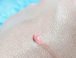 Biodermal Sun Lipbalm SPF25 - Tube 12 Ml - Natural Pink - Lippenbalsem 9 Biodermal Sun Lipbalm SPF25 - Tube 12 Ml - Natural Pink - Lippenbalsem -Cosmeticawinkel 1200x927